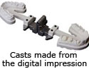 Casts made from the digital impression